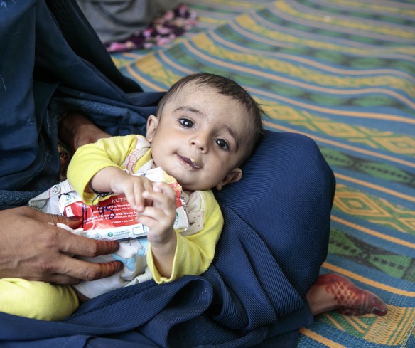 A child eats Plumpy'Nut, a peanut paste used to treat malnutrition.