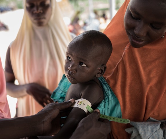 Un enfant est mesuré pour la malnutrition lors d'un dépistage nutritionnel d'Action contre la faim à Mayahi, au Niger.