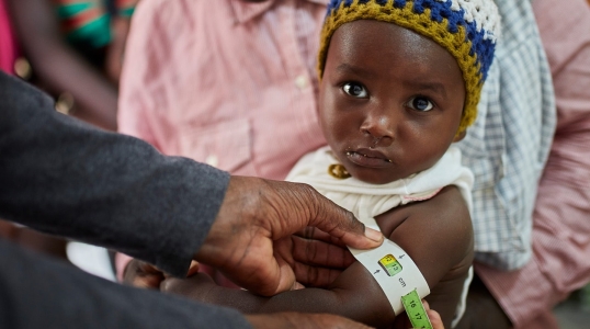 Measuring a child’s mid-upper arm circumference with a color-coded, graduated band is a cheap and simple way to detect undernutrition.