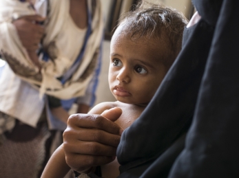 A child at one of Action Against Hunger’s health clinics in Yemen, a country on the brink of famine