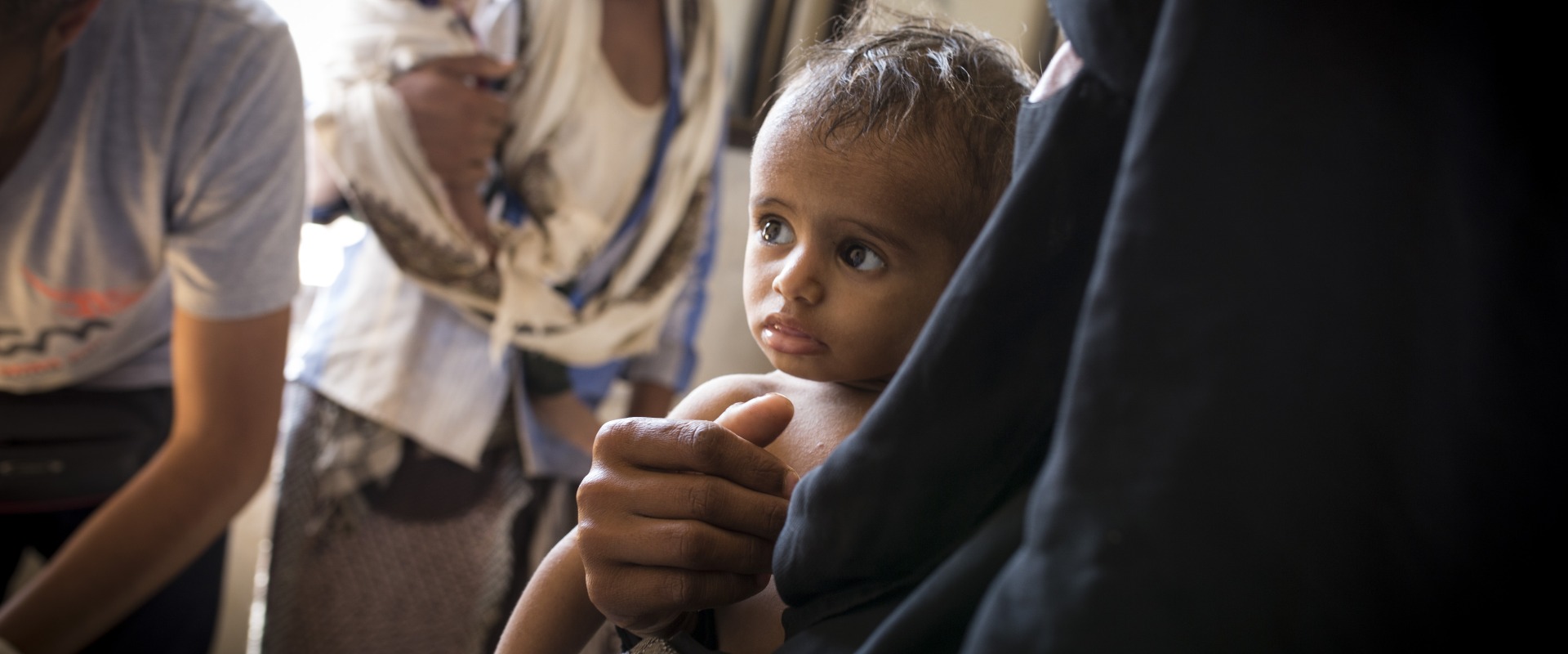 A child at one of Action Against Hunger’s health clinics in Yemen, a country on the brink of famine